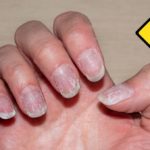 linhas finas nas unhas